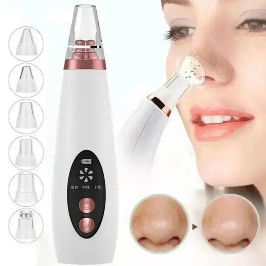 Blackhead Remover 6 in 1 Rechargeable - HT Bazar