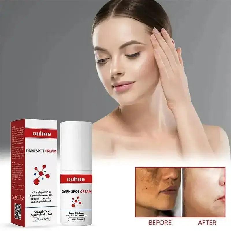 DETVFO Dark Spot Cream - HT Bazar