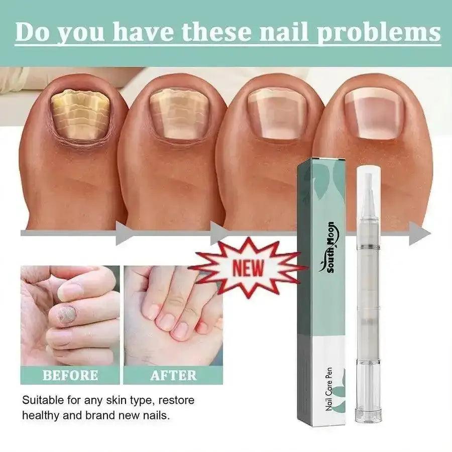 Nail care pen - HT Bazar